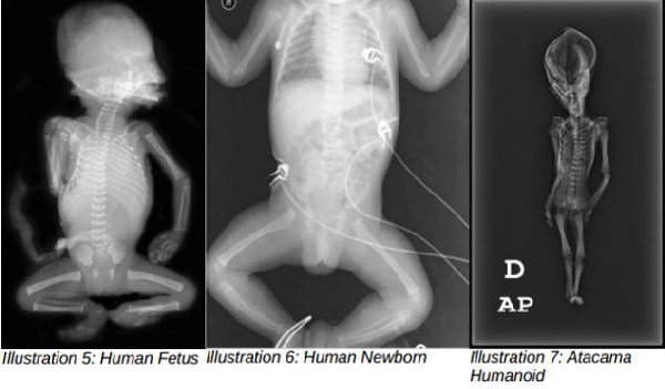 Cлева направо - человеческий зародыш, новорождённый, атакамский гуманоид.