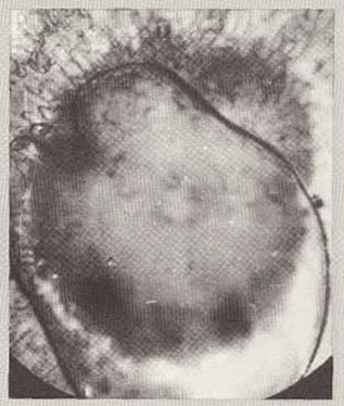 Разложение и деформация ядра (снимок сделан спустя шесть месяцев после гибели существа) 